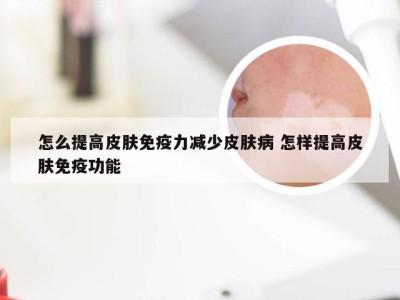 怎么提高皮肤免疫力减少皮肤病 怎样提高皮肤免疫功能