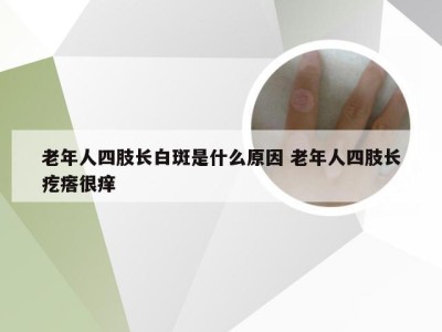 老年人四肢长白斑是什么原因 老年人四肢长疙瘩很痒