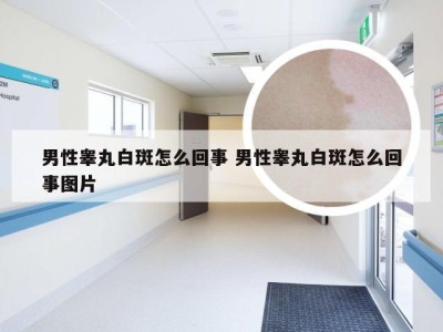 男性睾丸白斑怎么回事 男性睾丸白斑怎么回事图片