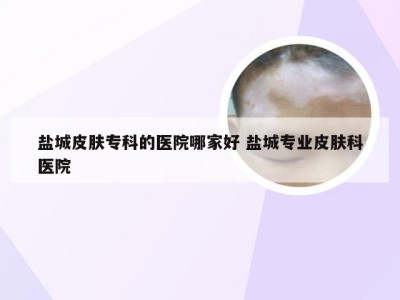 盐城皮肤专科的医院哪家好 盐城专业皮肤科医院