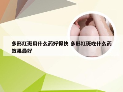 多形红斑用什么药好得快 多形红斑吃什么药效果最好