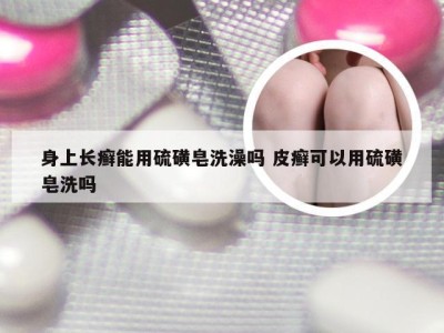 身上长癣能用硫磺皂洗澡吗 皮癣可以用硫磺皂洗吗