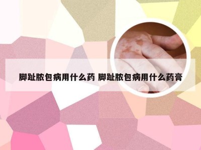 脚趾脓包病用什么药 脚趾脓包病用什么药膏