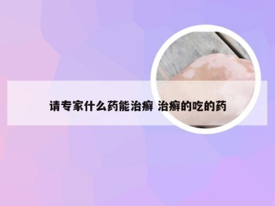 请专家什么药能治癣 治癣的吃的药