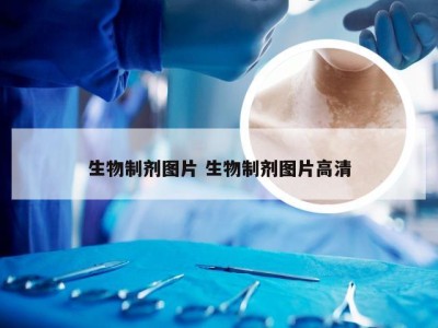 生物制剂图片 生物制剂图片高清