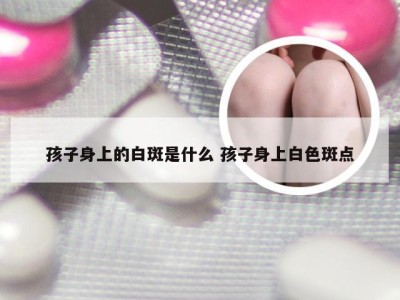 孩子身上的白斑是什么 孩子身上白色斑点