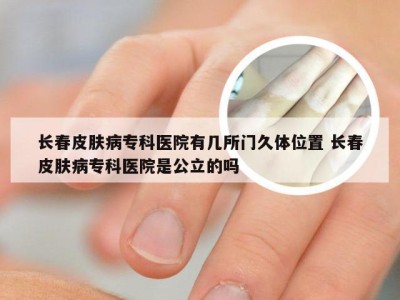 长春皮肤病专科医院有几所门久体位置 长春皮肤病专科医院是公立的吗