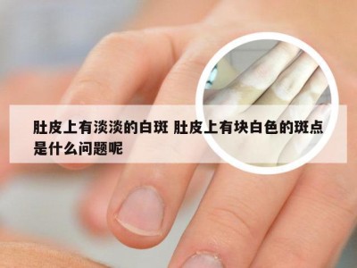 肚皮上有淡淡的白斑 肚皮上有块白色的斑点是什么问题呢