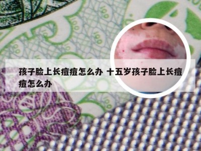 孩子脸上长痘痘怎么办 十五岁孩子脸上长痘痘怎么办