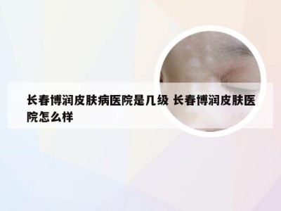 长春博润皮肤病医院是几级 长春博润皮肤医院怎么样