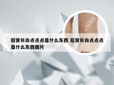 后背长白点点点是什么东西 后背长白点点点是什么东西图片