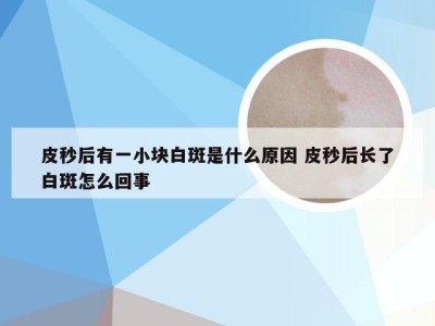 皮秒后有一小块白斑是什么原因 皮秒后长了白斑怎么回事