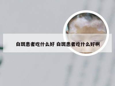 白斑患者吃什么好 白斑患者吃什么好啊