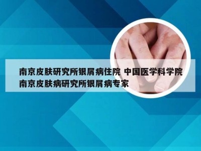 南京皮肤研究所银屑病住院 中国医学科学院南京皮肤病研究所银屑病专家