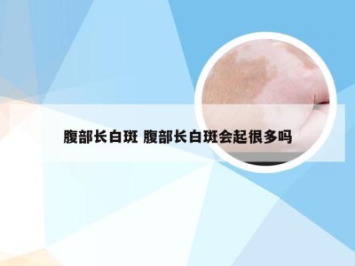 腹部长白斑 腹部长白斑会起很多吗