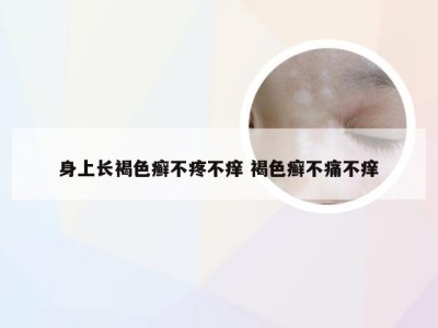 身上长褐色癣不疼不痒 褐色癣不痛不痒