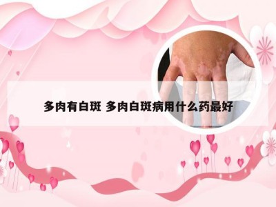 多肉有白斑 多肉白斑病用什么药最好