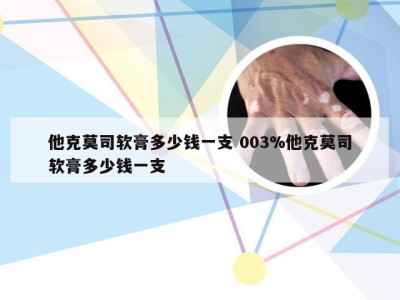 他克莫司软膏多少钱一支 003%他克莫司软膏多少钱一支