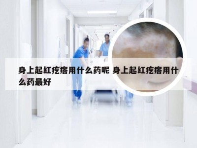 身上起红疙瘩用什么药呢 身上起红疙瘩用什么药最好