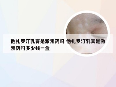 他扎罗汀乳膏是激素药吗 他扎罗汀乳膏是激素药吗多少钱一盒