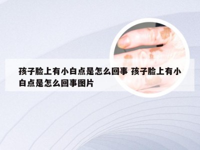 孩子脸上有小白点是怎么回事 孩子脸上有小白点是怎么回事图片