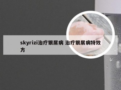 skyrizi治疗银屑病 治疗银屑病特效方