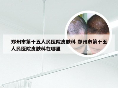 郑州市第十五人民医院皮肤科 郑州市第十五人民医院皮肤科在哪里