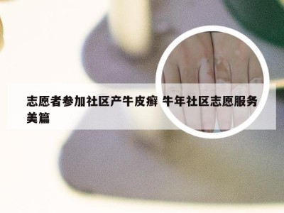 志愿者参加社区产牛皮癣 牛年社区志愿服务美篇