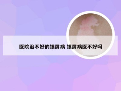 医院治不好的银屑病 银屑病医不好吗