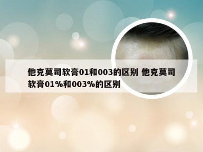 他克莫司软膏01和003的区别 他克莫司软膏01%和003%的区别