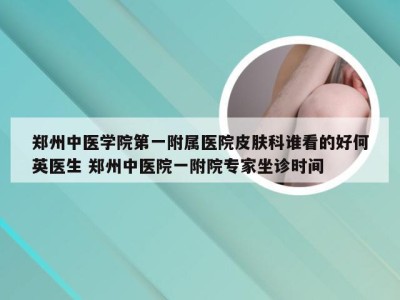 郑州中医学院第一附属医院皮肤科谁看的好何英医生 郑州中医院一附院专家坐诊时间