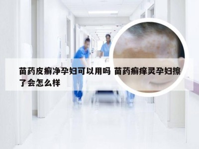 苗药皮癣净孕妇可以用吗 苗药癣痒灵孕妇擦了会怎么样