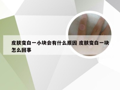 皮肤变白一小块会有什么原因 皮肤变白一块怎么回事