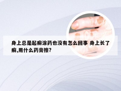 身上总是起癣涂药也没有怎么回事 身上长了癣,用什么药膏擦?