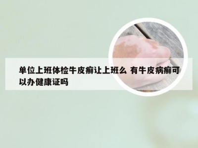 单位上班体检牛皮癣让上班么 有牛皮病癣可以办健康证吗