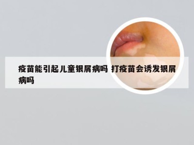 疫苗能引起儿童银屑病吗 打疫苗会诱发银屑病吗