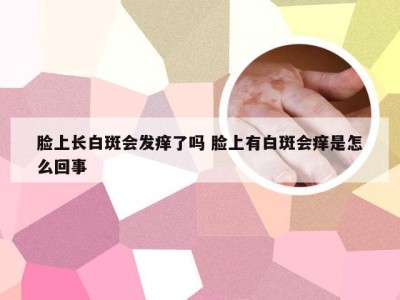 脸上长白斑会发痒了吗 脸上有白斑会痒是怎么回事