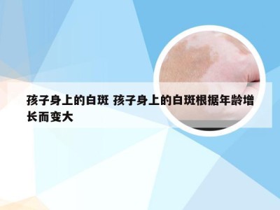 孩子身上的白斑 孩子身上的白斑根据年龄增长而变大