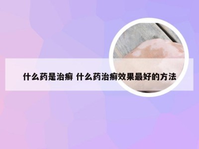 什么药是治癣 什么药治癣效果最好的方法