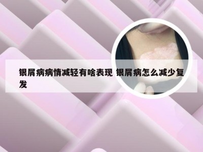 银屑病病情减轻有啥表现 银屑病怎么减少复发