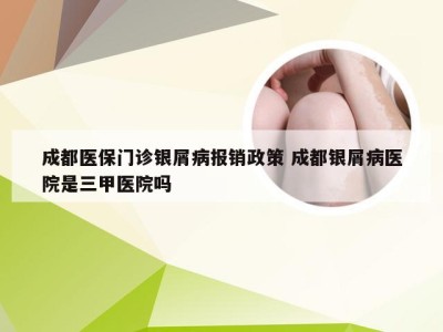 成都医保门诊银屑病报销政策 成都银屑病医院是三甲医院吗