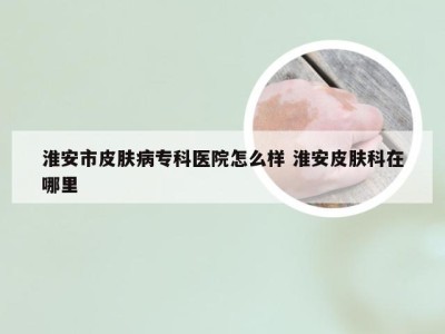 淮安市皮肤病专科医院怎么样 淮安皮肤科在哪里