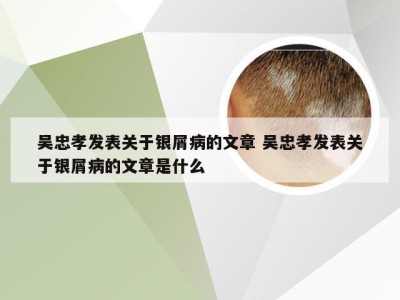 吴忠孝发表关于银屑病的文章 吴忠孝发表关于银屑病的文章是什么