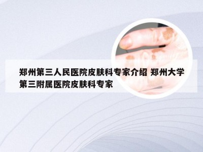 郑州第三人民医院皮肤科专家介绍 郑州大学第三附属医院皮肤科专家