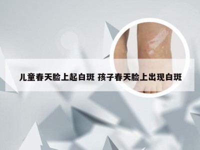 儿童春天脸上起白斑 孩子春天脸上出现白斑