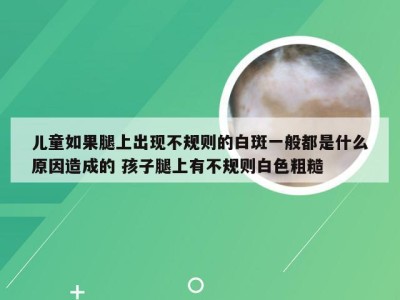 儿童如果腿上出现不规则的白斑一般都是什么原因造成的 孩子腿上有不规则白色粗糙