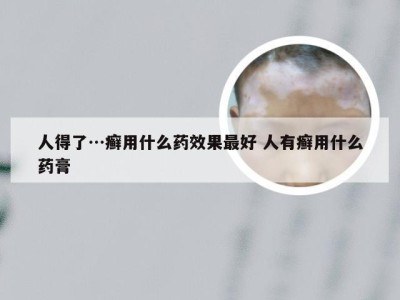 人得了…癣用什么药效果最好 人有癣用什么药膏