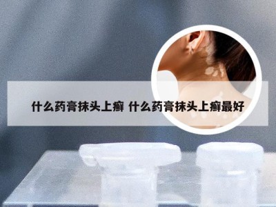 什么药膏抹头上癣 什么药膏抹头上癣最好