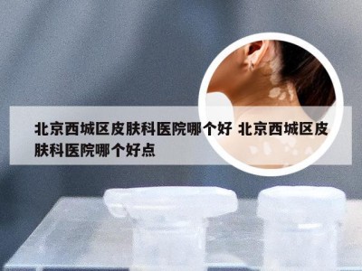 北京西城区皮肤科医院哪个好 北京西城区皮肤科医院哪个好点