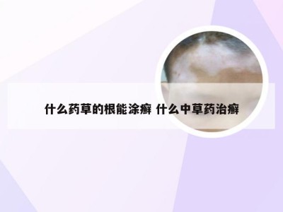 什么药草的根能涂癣 什么中草药治癣